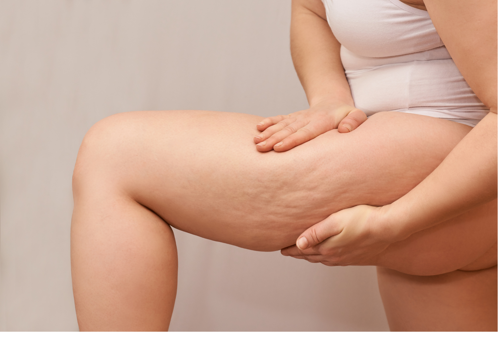 Cellulite : que faire ?